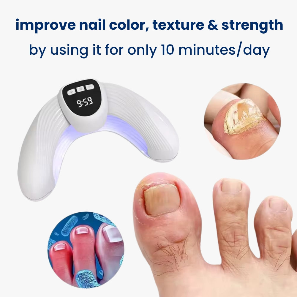 Nail fungal laser treatment